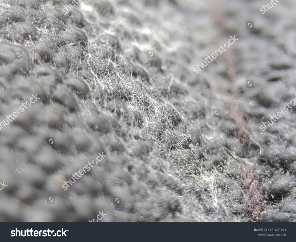 stock-photo-mold-white-fungus-on-the-skin-spores-of-fungus-closeup-macro-photo-background-copy-space-1151600453.jpg